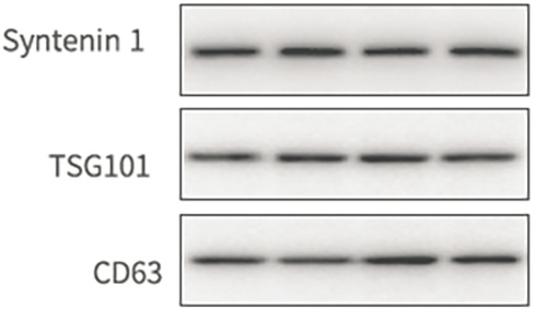 外泌體Western Blot圖（Tian Su et al., ACS Nano. 2019）